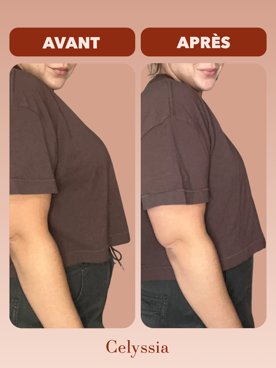 Soutien-gorge MinimaBra™ | Réduit le volume de la poitrine, sans la tasser