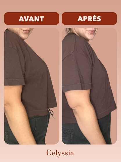 Soutien-gorge MinimaBra™ | Réduit le volume de la poitrine, sans la tasser